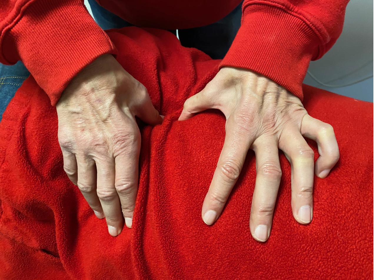 Dr. Ray Koury's hands — over 25 years of sports chiropractic care